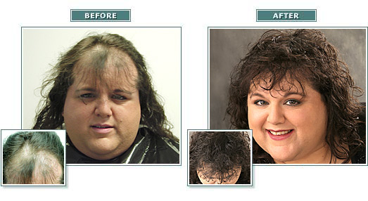 beforeafter_full_gina