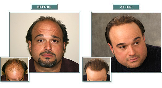 beforeafter_full_joec