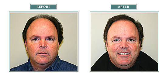 beforeafter_jeffsearle