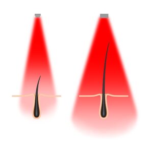 Diagram of beam differences between through-hole and SMT diodes: the SMT diode has a wider energy beam