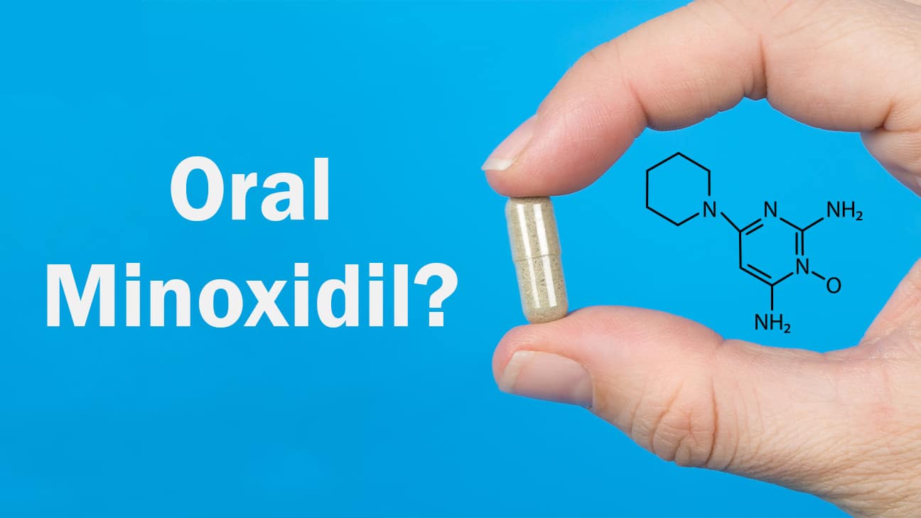 Should you use oral minoxidil instead of minoxidil?