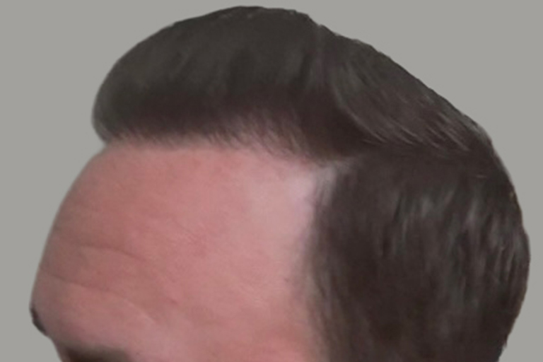 after