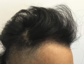 after